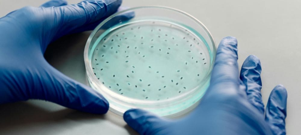 Investigación sobre CBD y antibióticos en cultivo bacteriano en laboratorio